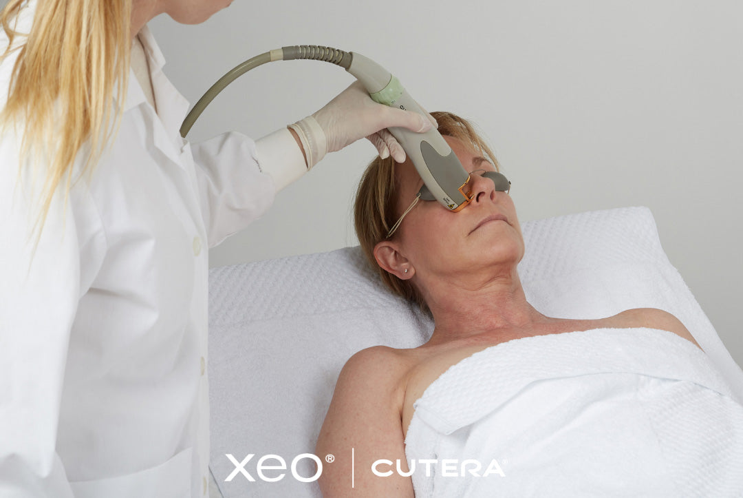 Skin Resurfacing Laser Genesis Treatment on a woman's Face on a Medical Spa Bed