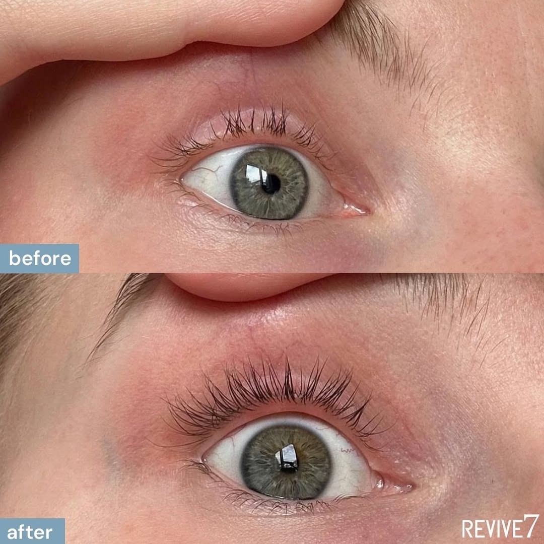 Close up of missing lashes on the top, and after the Revive 7 serum use, how much the lashes have grown in